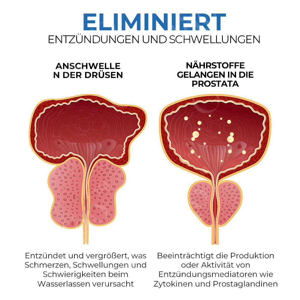 Oveallgo™ BullUp Naseninhalator mit Doppellöchern für die Gesundheit der Prostata