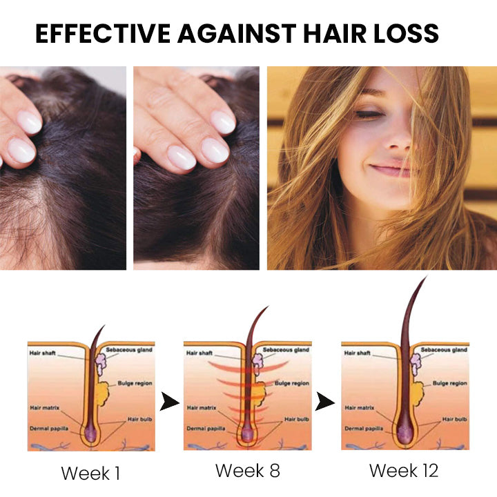 Oveallgo™ ShougaGRO Japanisches Haarwachstumsspray