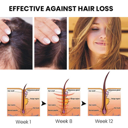 Oveallgo™ ShougaGRO Japanisches Haarwachstumsspray